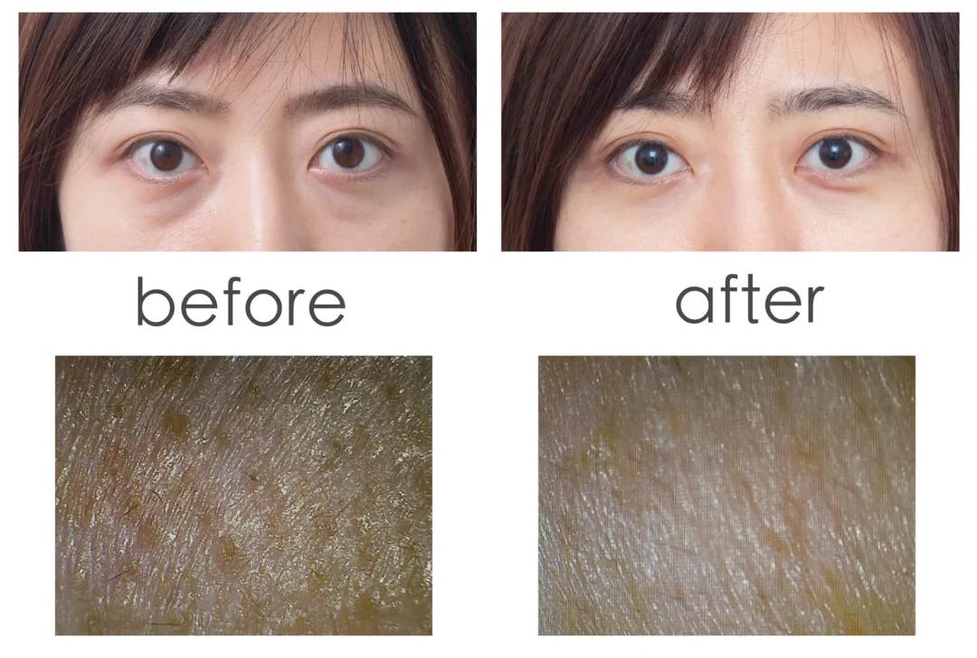 美肌修护焕彩眼霜,美肌保湿眼霜推荐