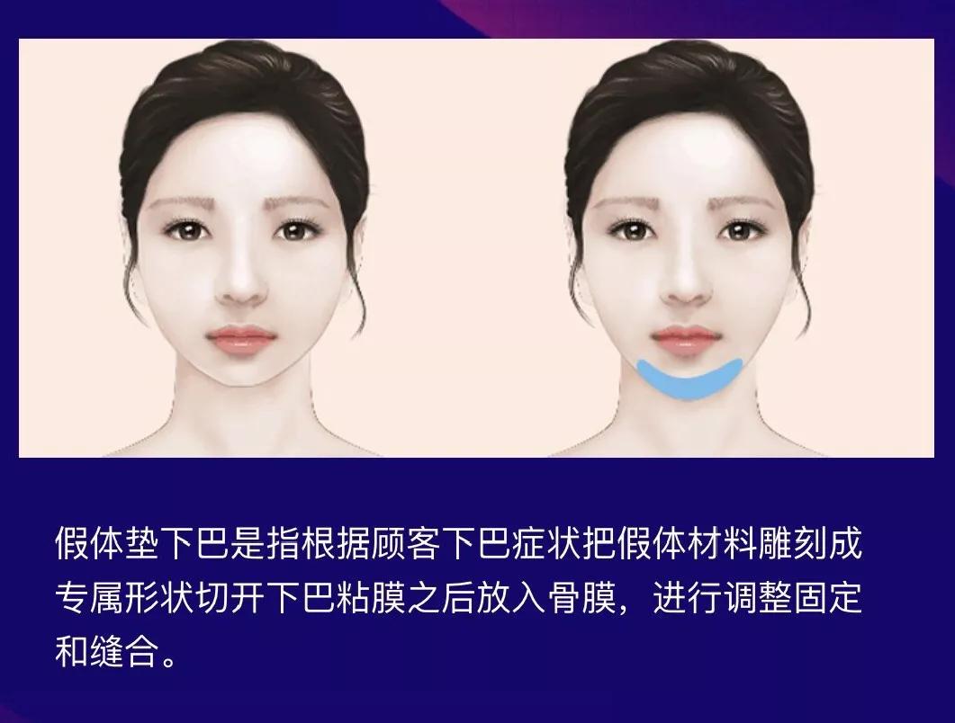 下巴短不尖怎么改善小窍门,下巴短没有后缩怎么改善