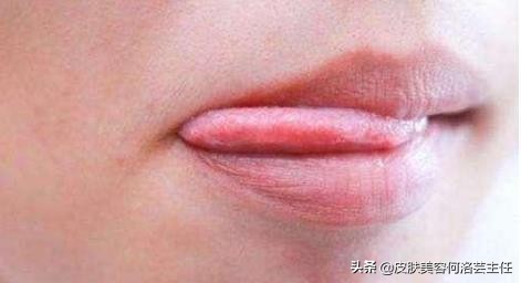 唇色发紫和唇色深,唇色深怎么办四大技巧改善唇色深