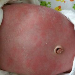 新生儿7个看似异常、其实正常的生理现象，你知道几个？建议收藏