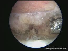 左侧肩膀疼痛预示十种病,哪些病可引起肩膀痛后背痛颈椎痛