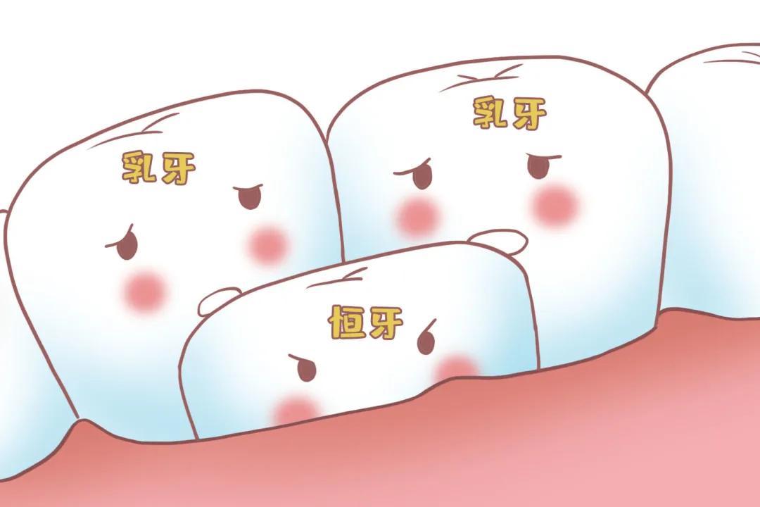 姚晨自曝儿子换牙问题,很多孩子中招!牙齿健康,家长们都要注意