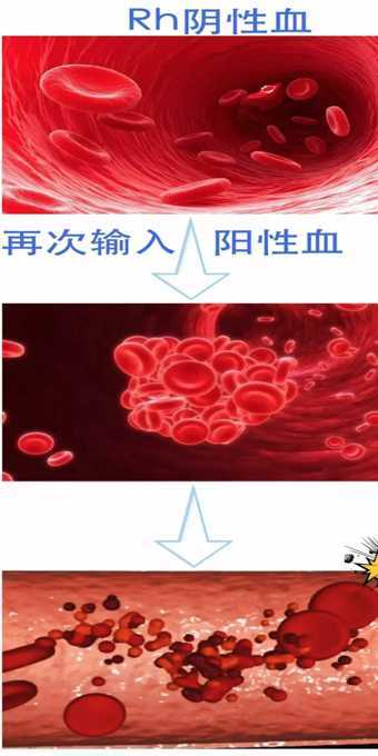 不同类型的血型会怎样,血型分析与血型特征