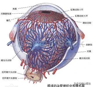 豹纹状眼底是什么原因引起的,近视眼都有豹纹状眼底吗
