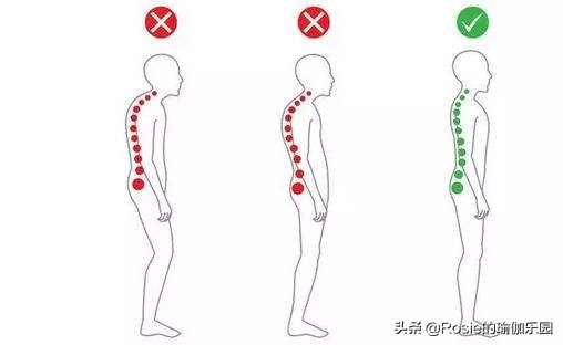 你以为你是翘臀其实是骨盆前倾,你以为的翘臀有可能是骨盆前倾