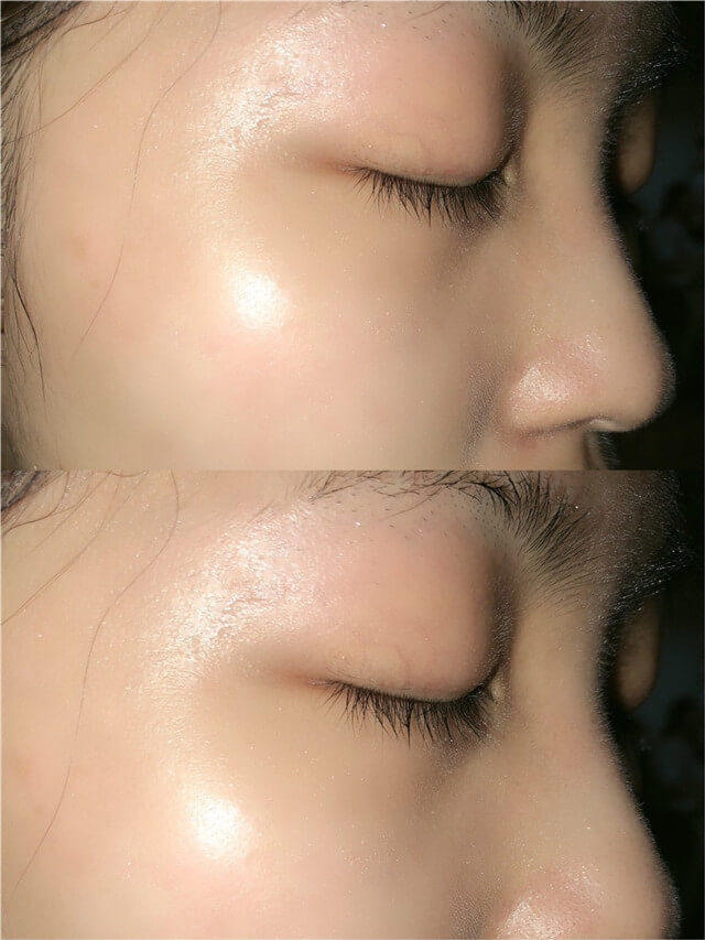 正确补水科普知识,补水和保湿怎么选