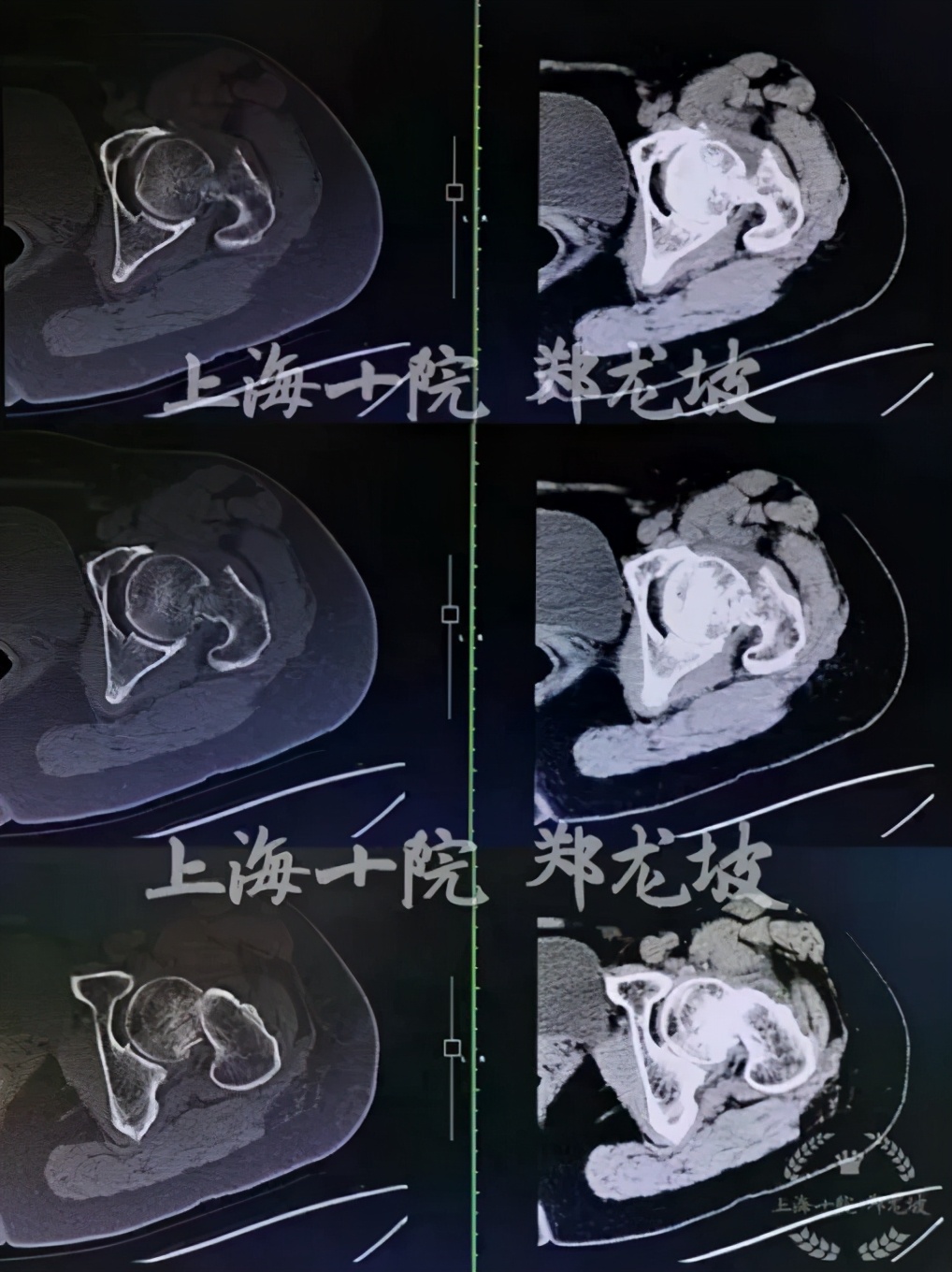 上海十院骨科手术量,上海骨科手术机器人