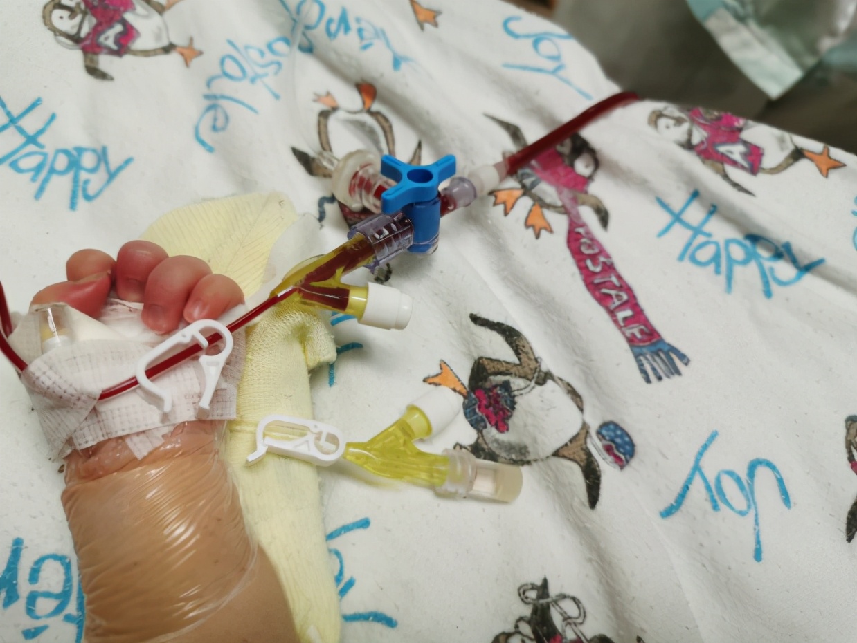 母婴血型不合新生儿溶血病,母婴血型相克