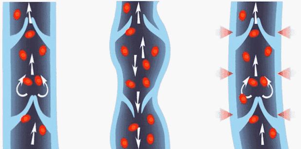 明星瘦腿方法让腿变又细又直,娱乐圈腿精女星