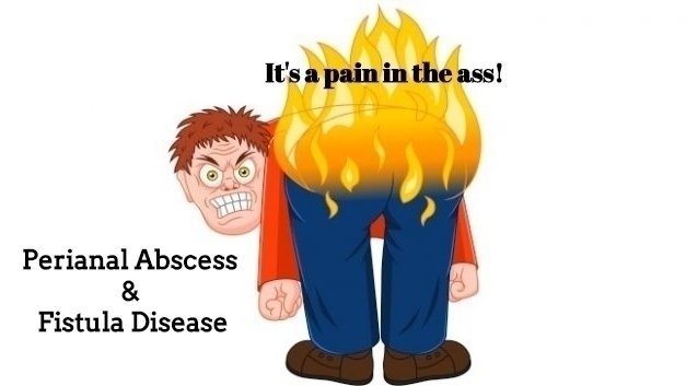 肛周脓肿系列介绍,肛周脓肿是因为什么原因引起的
