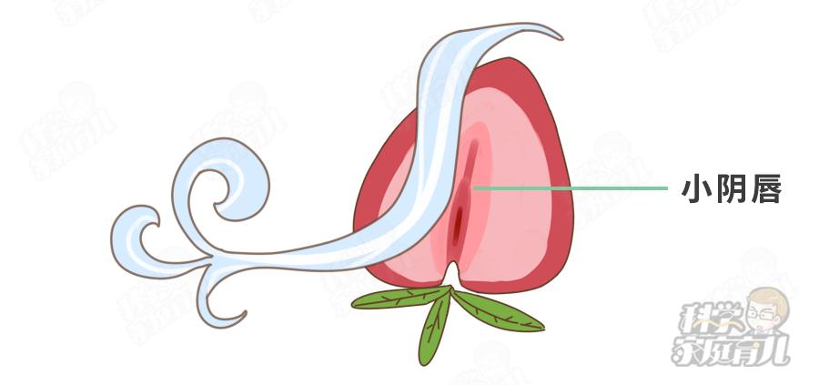 错不起!娃阴唇粘连,一碰就哭,到了这种程度,必须处理