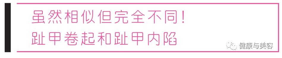 脚趾甲已经剪成圆形怎么办,脚趾甲长进肉怎么剪才不会痛