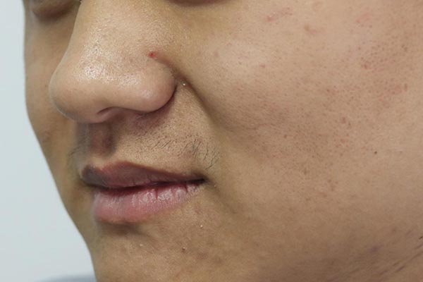 皮肤发黄吃什么维生素,皮肤发黄吃什么蔬菜好