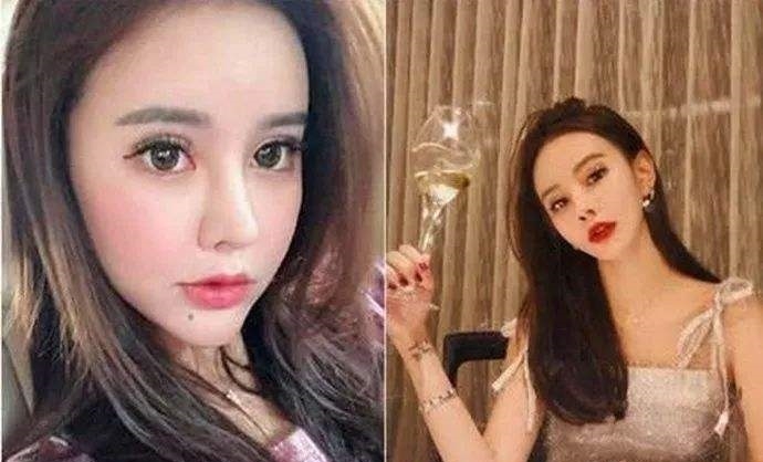 导演为什么不让演员整容,为什么导演不喜欢整容的演员