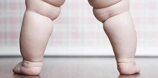 儿童膝外翻足内翻同时出现,儿童膝内翻
