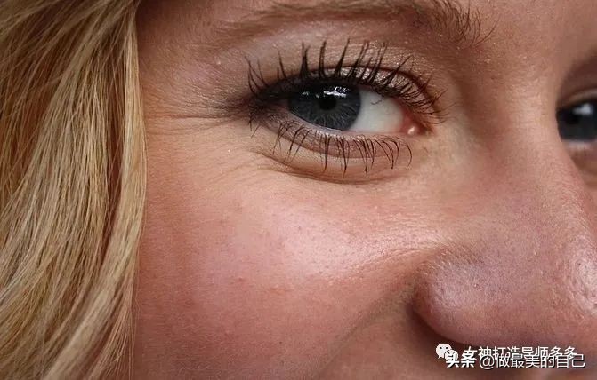 斑点暗黄肌最全的改善小技巧,都在这里