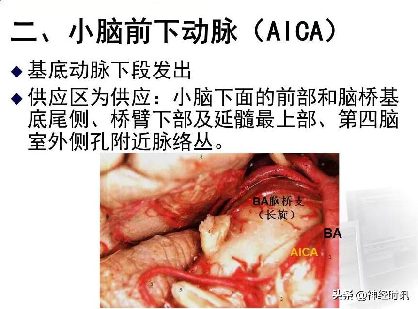脑动脉解剖学讲解,基底节区脑血管解剖
