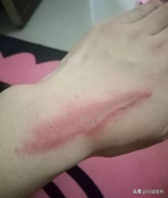 @云浮人虫出没，请注意！