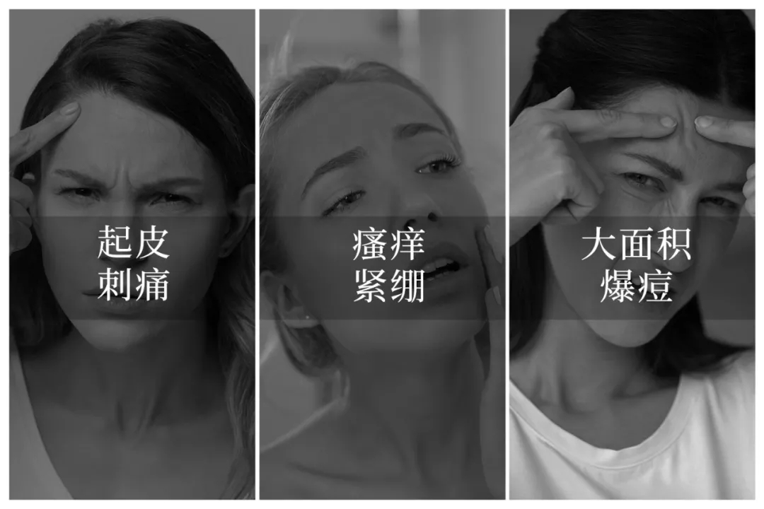 敏感长痘红痒该怎么办,红痘痒痛