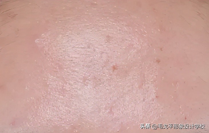 经常化妆长痘怎么办,长脸怎么从无效化妆变成有效化妆