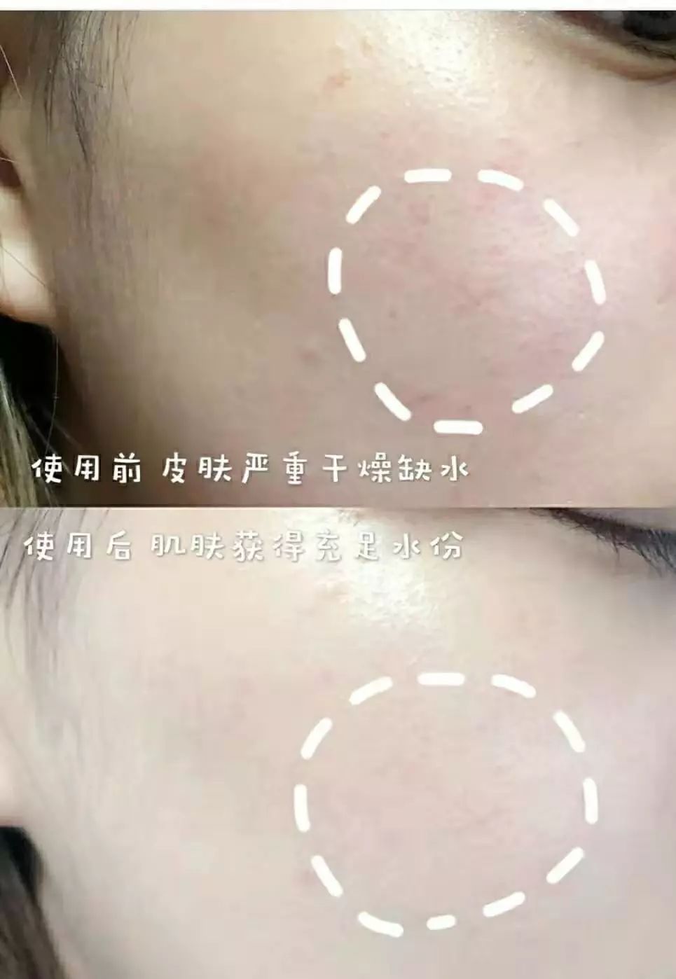 45岁金喜善素颜,金喜善冻龄秘密