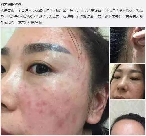 21亿智商税?屡遭质疑的微商面膜如此赚钱!林志玲陶虹都陷入了