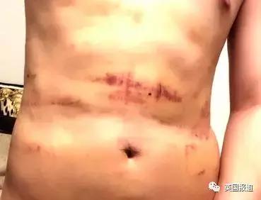 日本男子花费200万整容变成狗,日本整容小哥