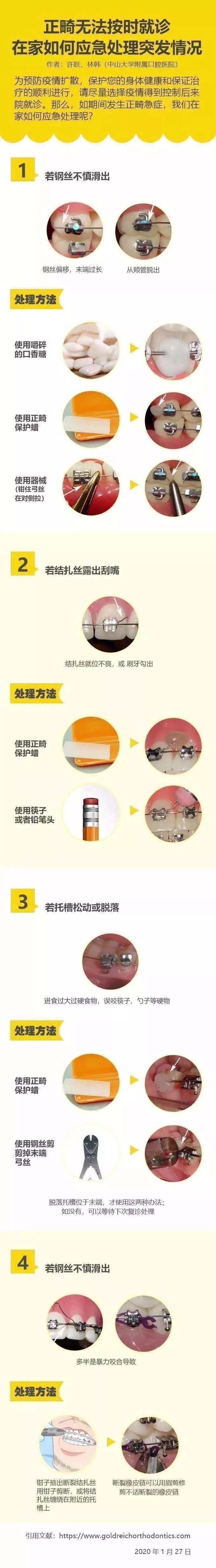 疫情期间牙齿出现问题怎么办,疫情期间牙齿掉了怎么处理