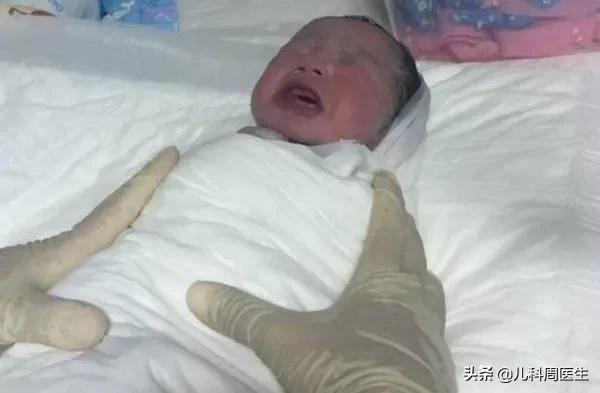 出生第二天宝宝皮下有出血点,40多天的新生儿皮下出血怎么办