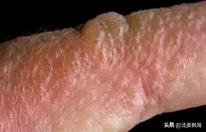 加拿大最危险五大动物,全球十大危险有毒动物