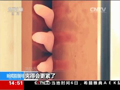 小孩手被门夹了怎么快速处理,小孩手被门夹了手微肿能自由活动