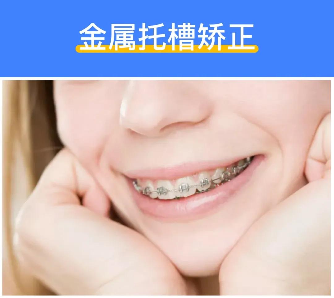 揭秘矫正牙齿多少钱,牙齿矫正全过程价格