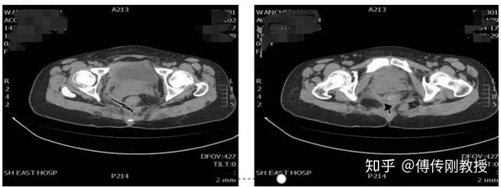 经历各种手术才活下来,经历了很多次手术
