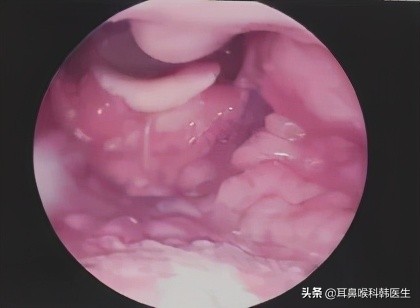为啥来院就做内镜检查？医生怕是在骗我钱吧