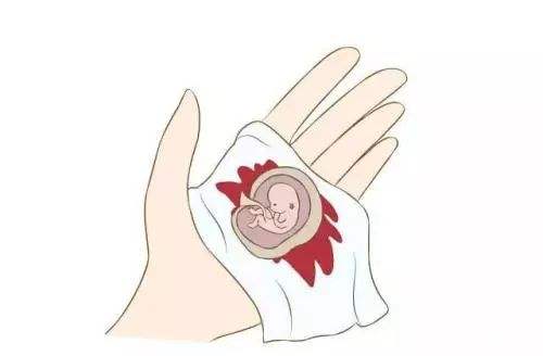 意外怀孕药流可靠吗,意外怀孕吃药能流干净吗