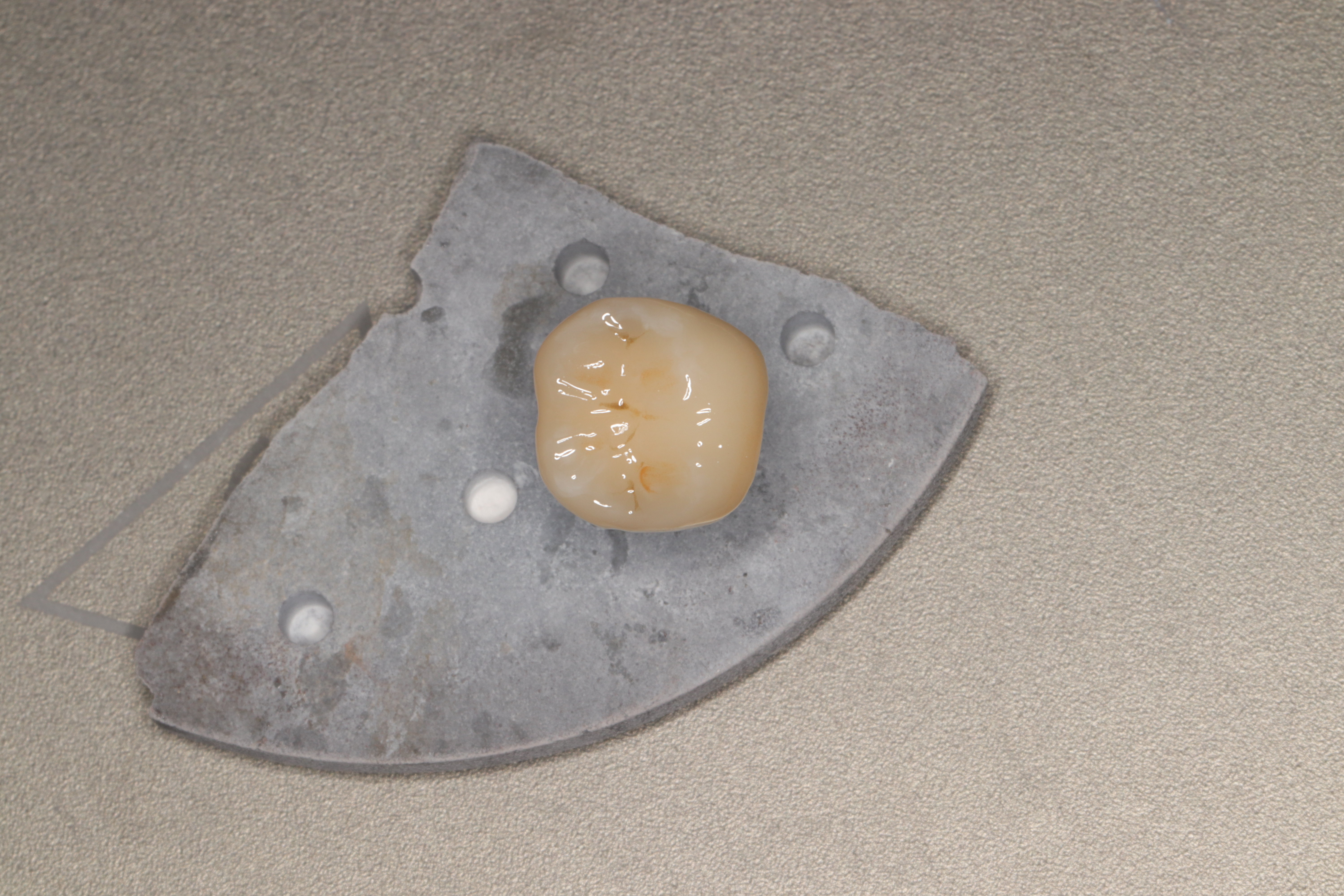 补牙补次数多了洞会越来越大吗,补牙补几次能补完