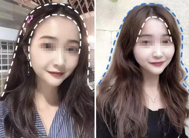 去头屑去螨虫哪个洗发水最有效,去头屑去螨虫用哪个洗发水最有效