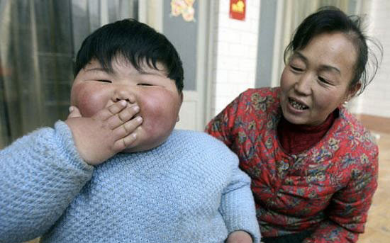 儿童肥胖身高比同龄人高,60岁身高150体重60公斤算肥胖吗