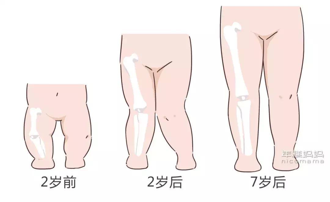 这些习惯影响宝宝腿发育，尤其是穿这两种鞋