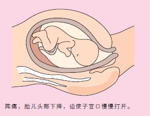 宝宝顺产出生的过程,剖腹产的小孩比顺产的小孩胆小吗