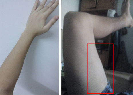 夏天晒黑怎么恢复美白,夏天晒黑了怎么快速变白