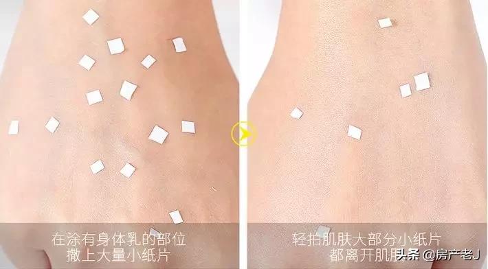 腿上长鱼鳞片状的皮屑怎么办,腿上起皮屑就是鱼鳞病