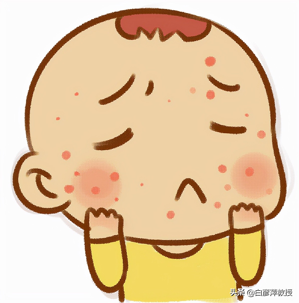 湿疹和荨麻疹症状有什么区别,红疹和湿疹的区别