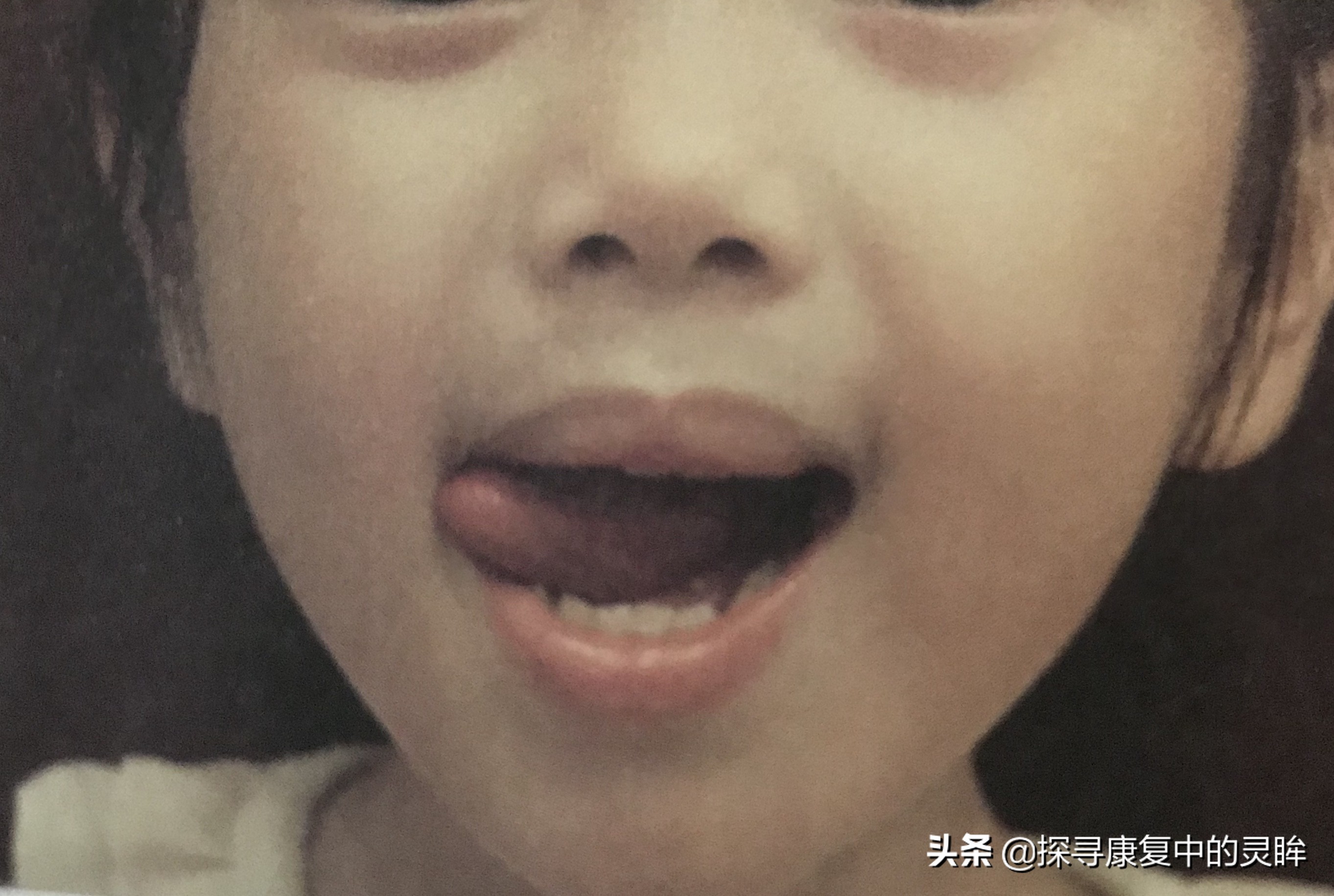 五种口部运动:灵活孩子的樱桃小嘴,让他们说话更清晰(超简单)