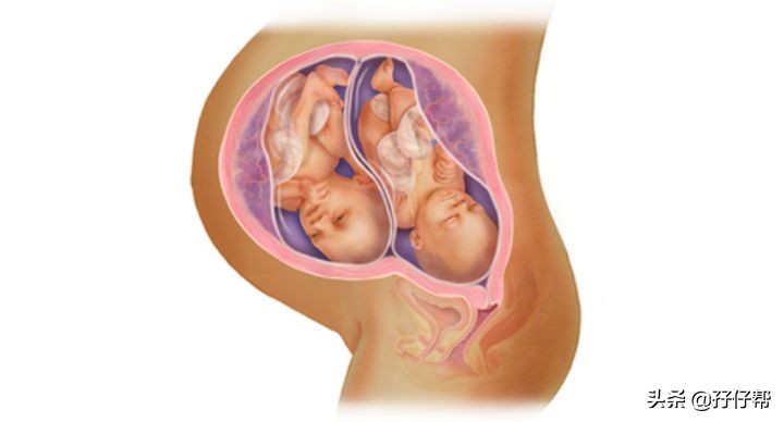 我的顺产日记双胞胎,自序随笔