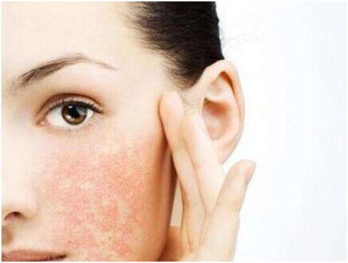皮肤泛红刺痛是怎么回事,皮肤泛红刺痛用什么修复