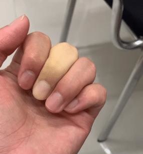 什么情况下医生会建议截肢,医生一般什么情况才建议截肢