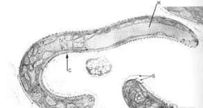 猫的传染病都有哪几种病症,猫咪为什么会传染严重的猫疾病