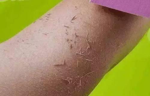 洗澡搓出来的泥每天都可以洗,洗澡搓出来的泥增多了