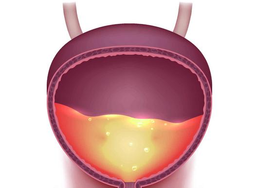 夜尿频繁,要警惕是这3种病的“暗示”,莫大意